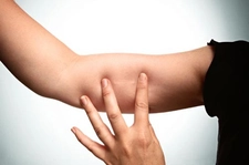 Kola Kramp Girmesi Belirtileri ve Tedavisi